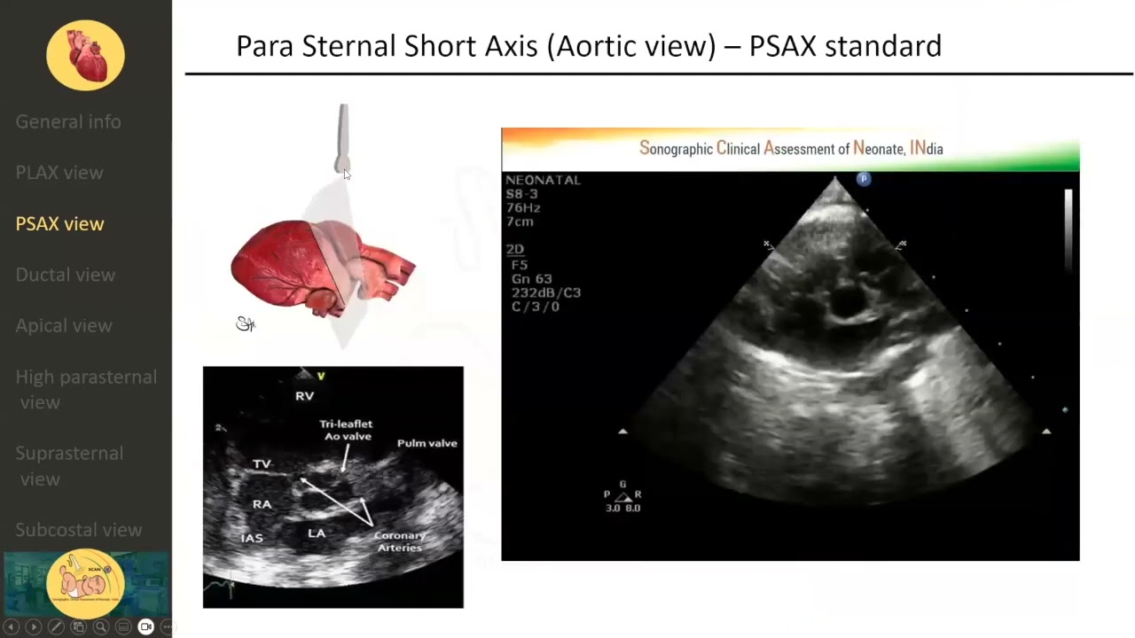 Functional echocardiography basics