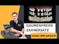 Teleskop Prothese | Herausnehmbarer Zahnersatz gaumenfrei bei Zahnarzt Dr. Rainer Sorg in Welzheim