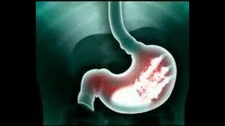 Download lagu ProMag Double Action