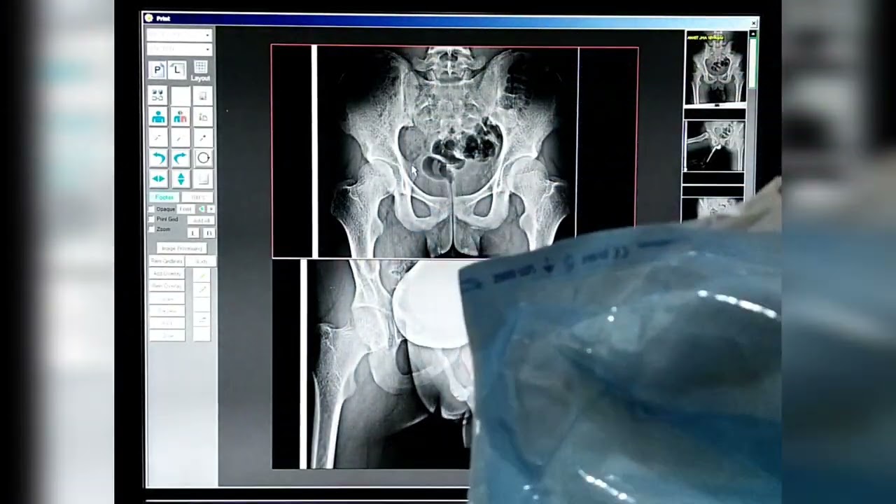 RGU and MCU full details video instruments and practical | X-ray procedure rgu and mcu #rguhs  #mcu