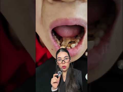 CALCULO DENTAL POR MONTÓN #shorts