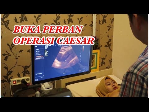 Video: Musuh Terbaik Caesar - Pandangan Alternatif