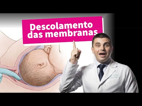 Vídeo: A varredura de membrana funcionou para você?