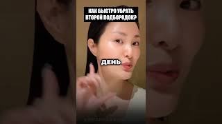Реальная альтернатива Ботоксу. Убираем второй подбородок