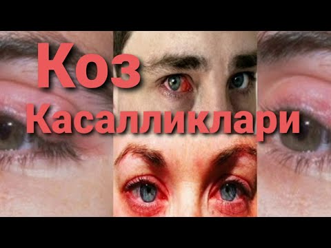 Video: Qushlarning Odatdagi Ko'z Kasalliklari