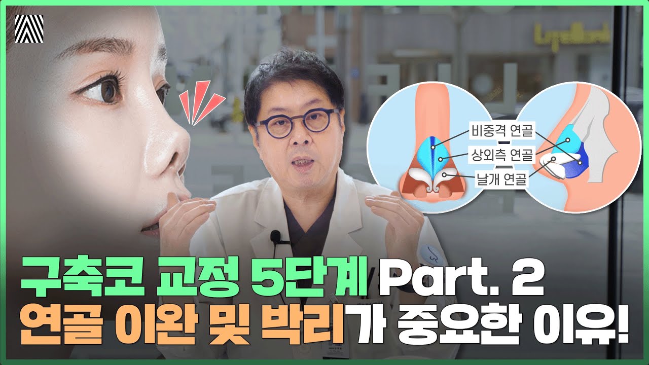 #2 구축코 교정 시 연골 이완 및 박리에 최선을 다하는 이유는 바로 '이것'_[4월31일 성형외과]