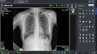 Full VXvue Quick Guide 03  Post processing X ray Images Update