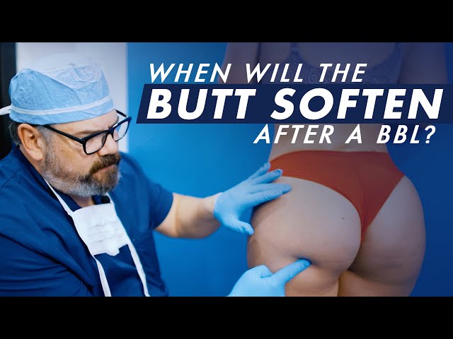 When Will the Butt Soften After a BBL? 