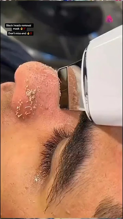 Black heads romoval mask 👌💯#gbcosmatics #blackheads #blackheadremoval #blackmask #urgentwhitening