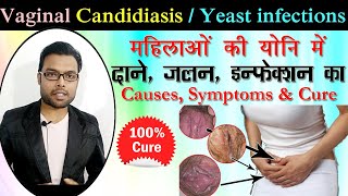 महिलाओं की योनि में दाने, जलन और इन्फेक्शन का इलाज | candida yeast infection treatment | Ayurvedic Resimi