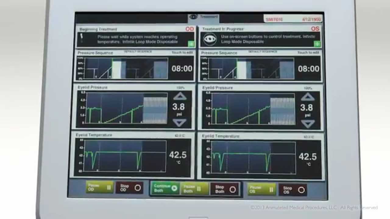 How does Lipiflow work?