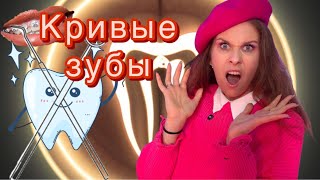 видео: Хейт, кривые зубы, осуждения, боль. Моя история брекетов. Почему я сделала бы снова #катяклон картинка: Хейт, кривые зубы, осуждения, боль. Моя история брекетов. Почему я сделала бы снова #катяклон