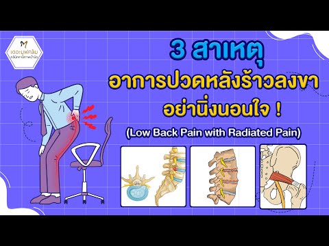 3 สาเหตุอาการปวดหลังร้าวลงขา อย่านิ่งนอนใจ ! ( Low Back Pain with Radiated Pain )