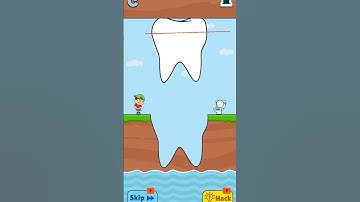 slice teeth 🤮 to save the funny games #shortsfeed #ytshorts #gaming #youtubeshorts #viralshorts