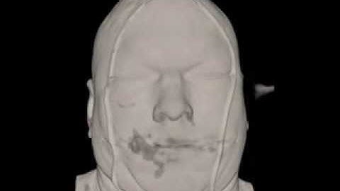 Human head volume rendering