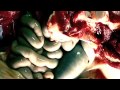Miniature de la vidéo de la chanson Empathological Necroticism