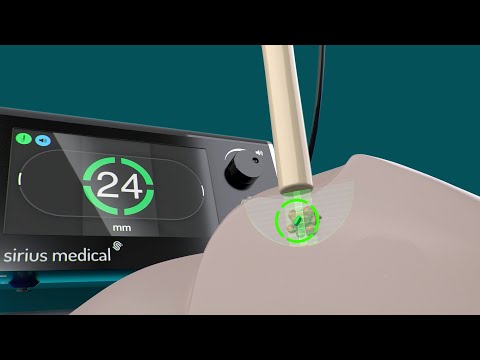 The Pintuition System Discussion With Dr Giblin