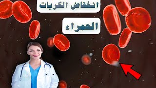 علاج انخفاض كريات الدم الحمراء