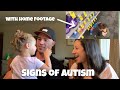 Autism Early Signs | Toddler Signs Of Autism With Footage