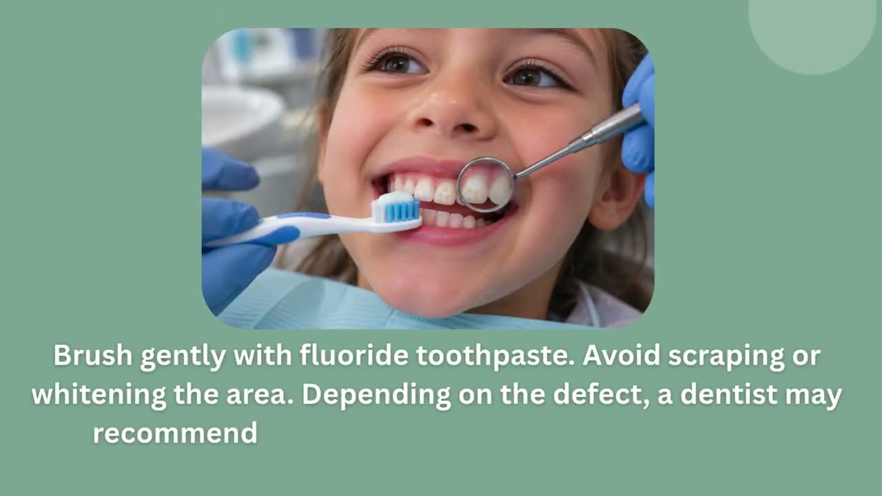 Turner’s Tooth in Kids