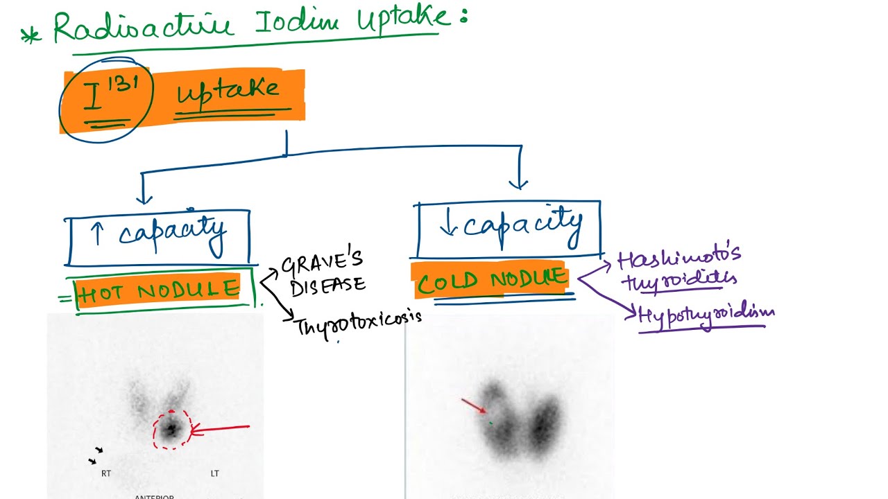 Thyroid Function Tests - Endocrine Physiology - YouTube