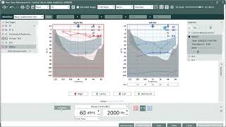 Weber Test In Auditdata Measure