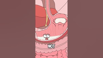 Why Your Stomach Must Stay Empty Before Surgery#animation #funny #shorts