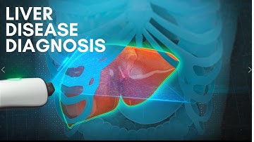 Liver Disease Diagnosis (3D medical animation 2022)