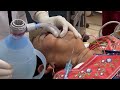 Adult resuscitation  cardiopulmonary resuscitation cpr  laryngoscope  neet dr raj