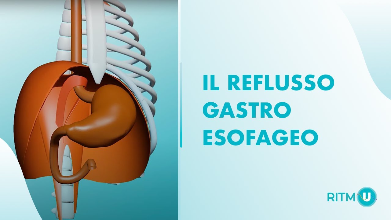 RITMU® lezione 13/18 Il Reflusso Gastro