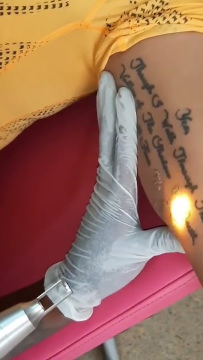 laser-tattoo-removal-in-kenya-call-0798606779-youtube
