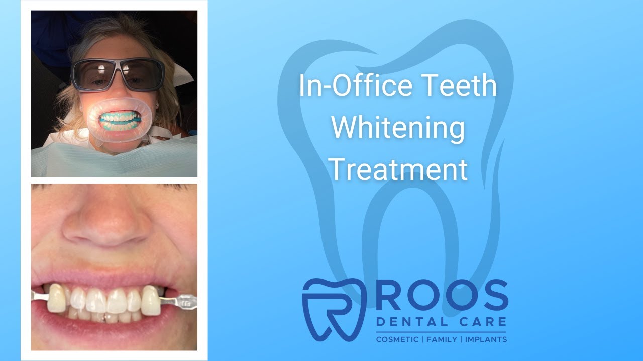 InOffice Teeth Whitening YouTube
