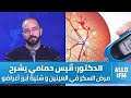 د انيس حمامي شنوا هو مرض السكر في العينين و شنية أبرز أعراضو وطرق العلاج 
