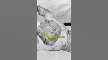 The Demon Core: The Nuclear Accidents That Changed Science