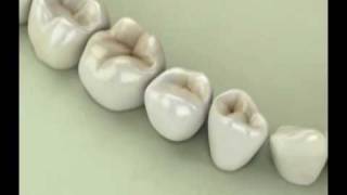 Title_01_99.avi