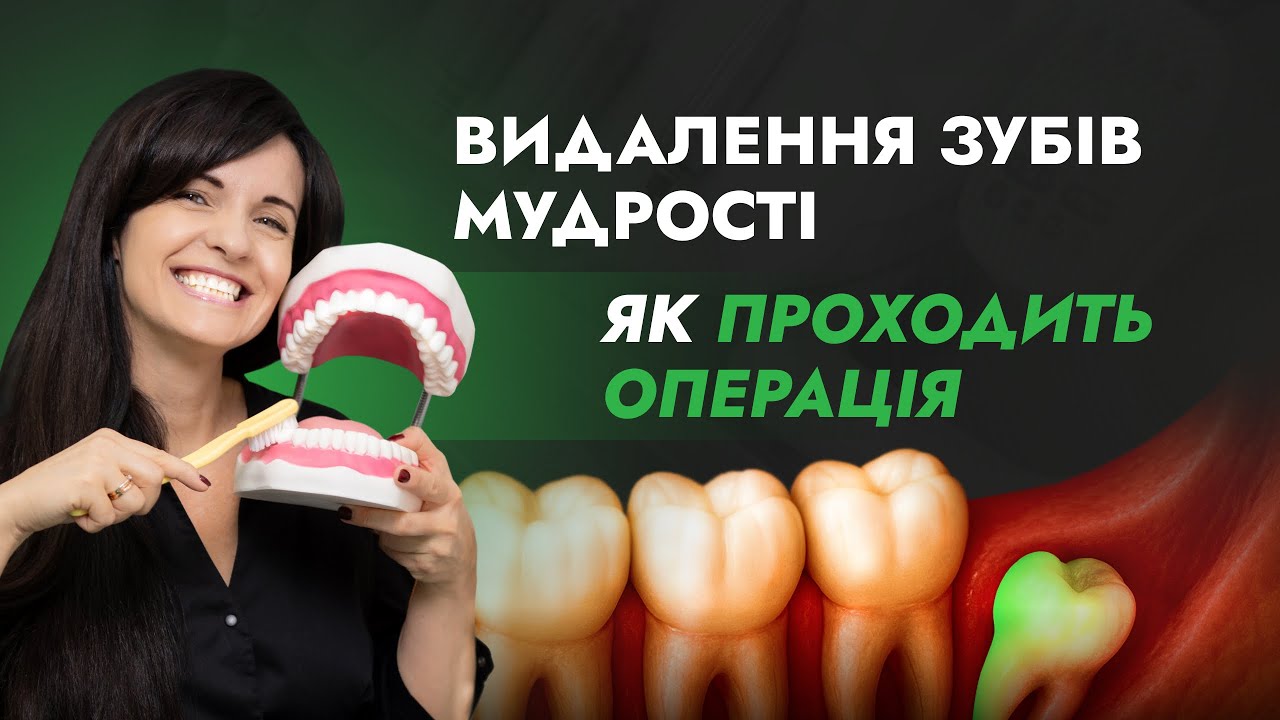 Атипове видалення зуба мудрості під наркозом який не прорізався: реабілітація, набряк, ускладнення