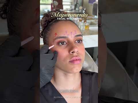 Mapeamento muscular antes da toxina botulínica — vídeo do Dr. Thiago Perfeito