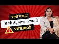 Never eat these foods  vitiligo special  dr nitika kohli