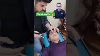 treatment sinusitis 😱 #cfr_sinus