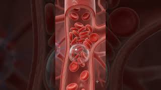 #AirEmbolism  follow Adam #AirBubbleInBloodstream #BloodCirculation #PatientSafety #NursingSafety