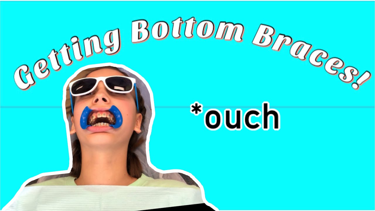 Mattie Gets Bottom Braces Youtube