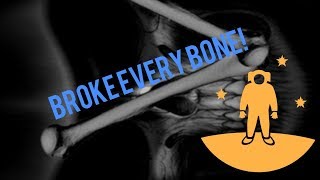 Roblox 3 Broken Bones Ultimate Apphackzone Com - roblox broken bones 2all secret maps