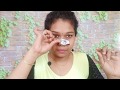 HOW I REMOVE BLACKHEADS & WHITEHEADS from Nose and Face#Blackheads Remover Strip Hip Hop#