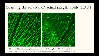Axon Regeneration: The Potential Therapy for Glaucoma Injury - Nam Tran Nguyen '22