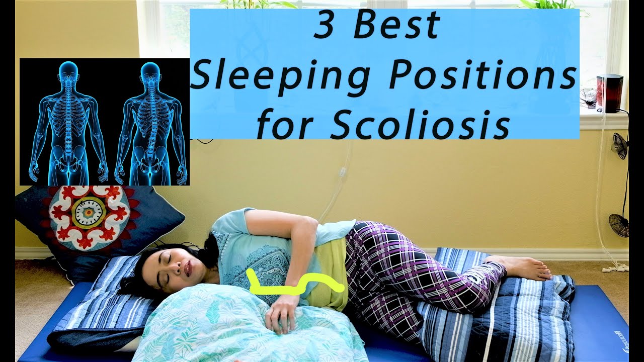 3 Best Sleeping Positions For Scoliosis 