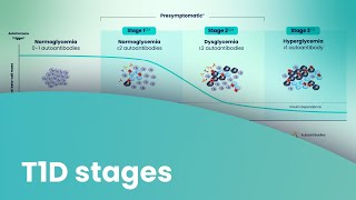 The Stages of Type 1 Diabetes
