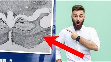 A DAY IN THE LIFE OF A PHD STUDENT IN NEUROSCIENCE