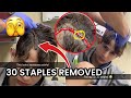 Nidal is getting staples removed from his head doctor checkup