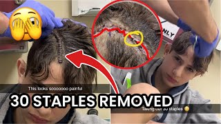 NIDAL IS GETTING STAPLES REMOVED FROM HIS HEAD🫣 (Doctor checkup)
