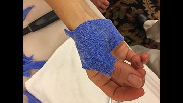 Short Opponens Orthosis 2